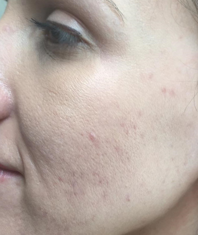 Yvette After Picture